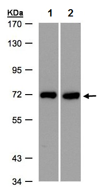 Western blot - Anti-T Plastin/PLS3 antibody (AB137585), expandable thumbnail