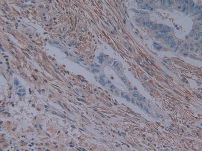 Immunohistochemistry (Formalin/PFA-fixed paraffin-embedded sections) - Anti-T Plastin/PLS3 antibody (AB233104)