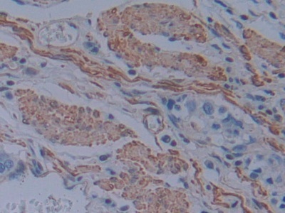 Immunohistochemistry (Formalin/PFA-fixed paraffin-embedded sections) - Anti-T Plastin/PLS3 antibody (AB233104), expandable thumbnail