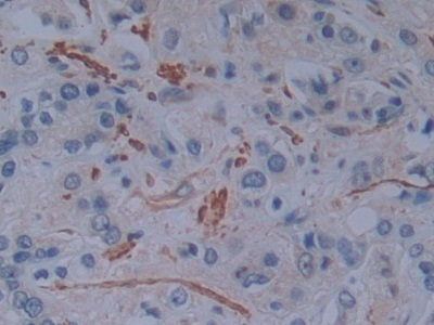 Immunohistochemistry (Formalin/PFA-fixed paraffin-embedded sections) - Anti-T Plastin/PLS3 antibody (AB233104), expandable thumbnail