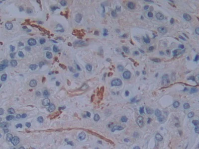 Immunohistochemistry (Formalin/PFA-fixed paraffin-embedded sections) - Anti-T Plastin/PLS3 antibody (AB233104)