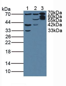 Western blot - Anti-T Plastin/PLS3 antibody (AB233104), expandable thumbnail