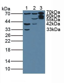 Western blot - Anti-T Plastin/PLS3 antibody (AB233104)