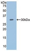 Western blot - Anti-T Plastin/PLS3 antibody (AB233104), expandable thumbnail