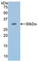 Western blot - Anti-T Plastin/PLS3 antibody (AB233104)
