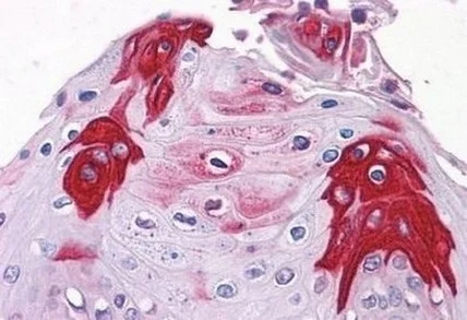 Immunohistochemistry (Formalin/PFA-fixed paraffin-embedded sections) - Anti-T1R3 antibody (AB150525)