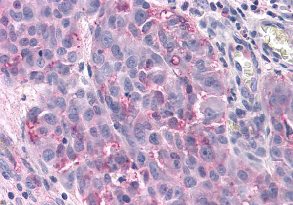 Immunohistochemistry (Formalin/PFA-fixed paraffin-embedded sections) - Anti-T1R3 antibody (AB150525)