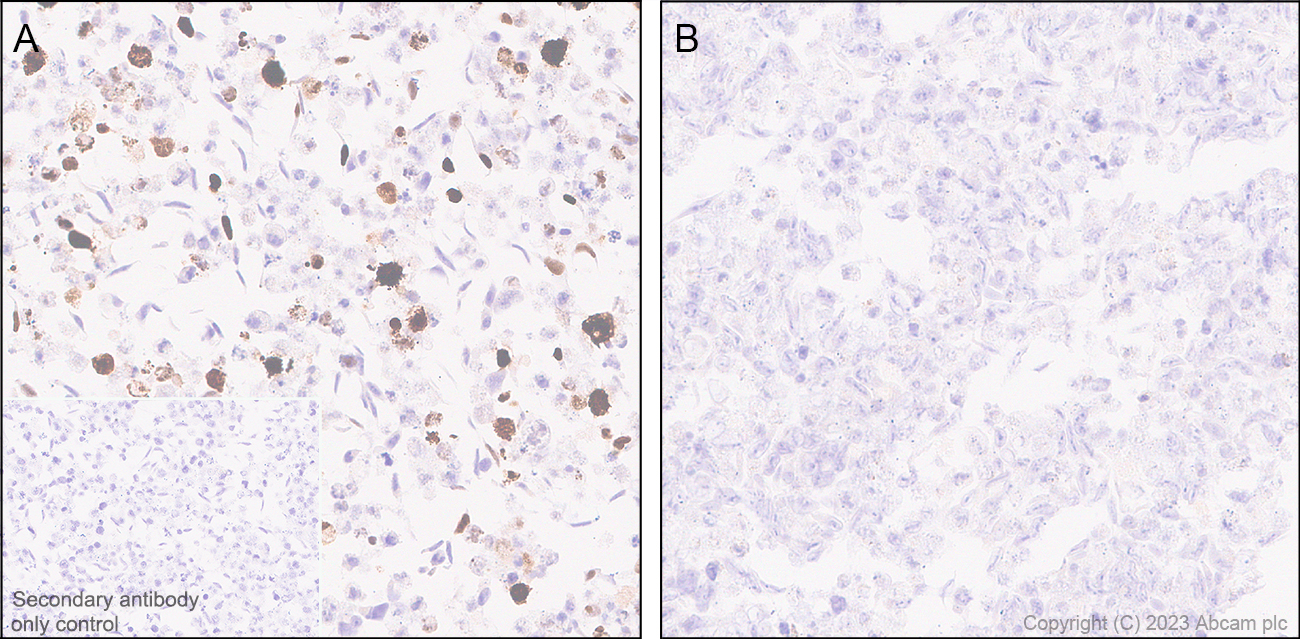 Immunohistochemistry (Formalin/PFA-fixed paraffin-embedded sections) - Anti-T7 tag® antibody [EPR28033-8] (ab317258), expandable thumbnail