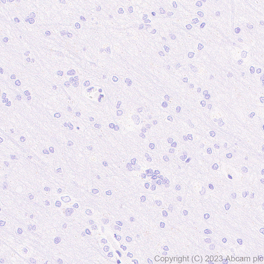 Immunohistochemistry (Formalin/PFA-fixed paraffin-embedded sections) - Anti-T7 tag® antibody [EPR28033-8] (ab317258), expandable thumbnail