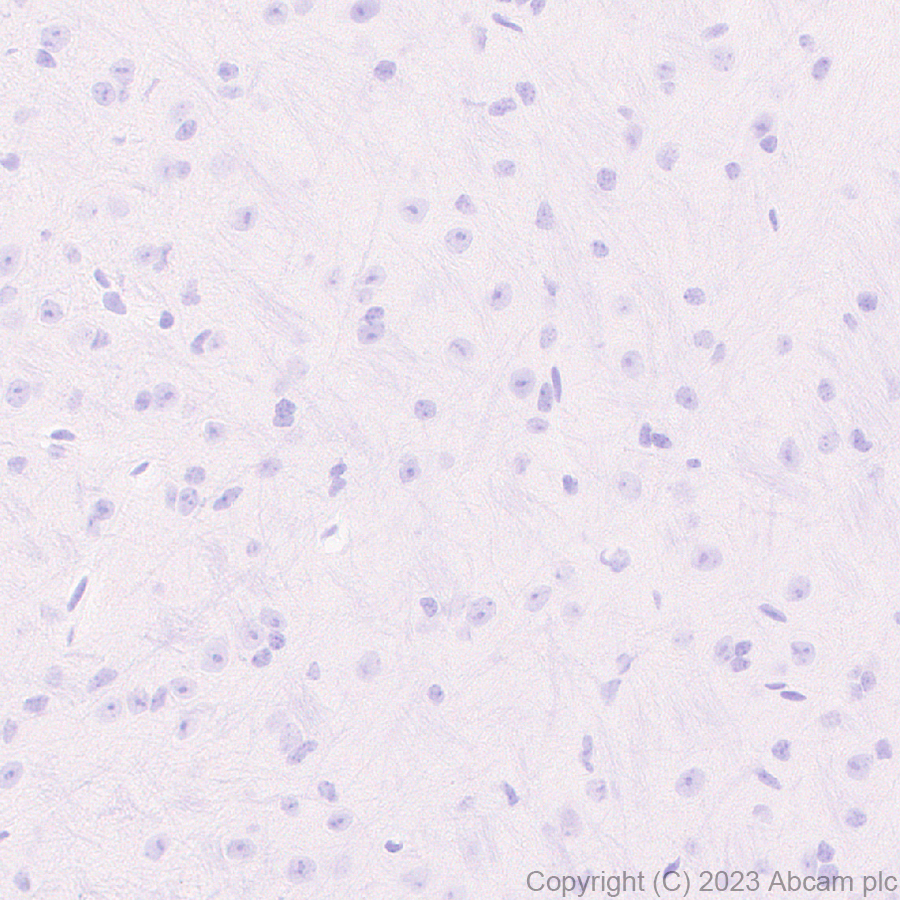 Immunohistochemistry (Formalin/PFA-fixed paraffin-embedded sections) - Anti-T7 tag® antibody [EPR28033-8] (ab317258), expandable thumbnail