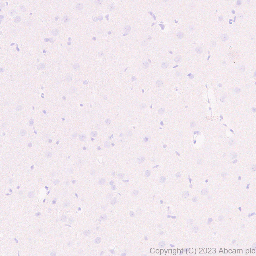 Immunohistochemistry (Formalin/PFA-fixed paraffin-embedded sections) - Anti-T7 tag® antibody [EPR28033-8] (ab317258), expandable thumbnail