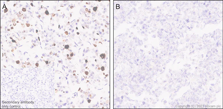 Immunohistochemistry (Formalin/PFA-fixed paraffin-embedded sections) - Anti-T7 tag® antibody [EPR28033-8] - BSA and Azide free (AB317259)