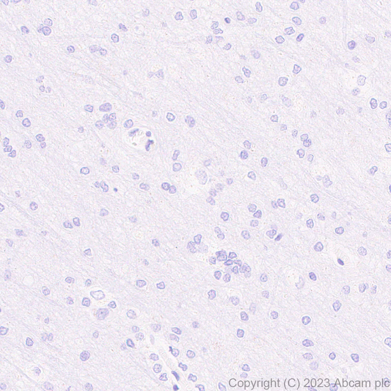 Immunohistochemistry (Formalin/PFA-fixed paraffin-embedded sections) - Anti-T7 tag® antibody [EPR28033-8] - BSA and Azide free (AB317259)