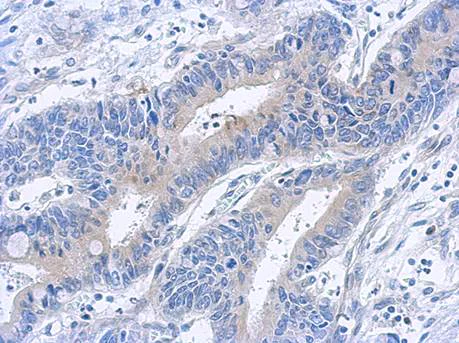 Immunohistochemistry (Formalin/PFA-fixed paraffin-embedded sections) - Anti-TAB1 antibody (AB151408)