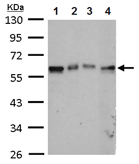 Western blot - Anti-TAB1 antibody (AB151408)