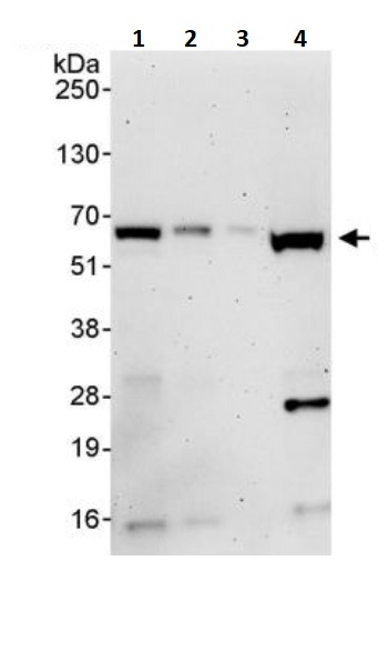 Western blot - Anti-TAB1 antibody (AB245587), expandable thumbnail