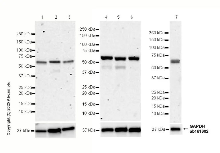 Western blot - Anti-TAB1 antibody [EPR29000-94] (AB324014)
