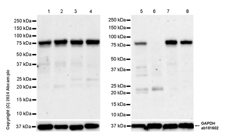 Western blot - Anti-TAB2 antibody [EPR19670-161] (AB317602)
