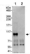 Immunoprecipitation - Anti-TAB3 antibody (AB85655)