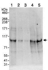 Western blot - Anti-TAB3 antibody (AB85655)