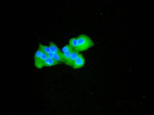 Immunocytochemistry/ Immunofluorescence - Anti-TAB3 antibody [EPR5965] (AB124723), expandable thumbnail