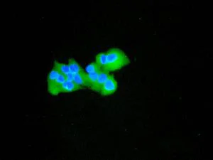 Immunocytochemistry/ Immunofluorescence - Anti-TAB3 antibody [EPR5965] (AB124723)