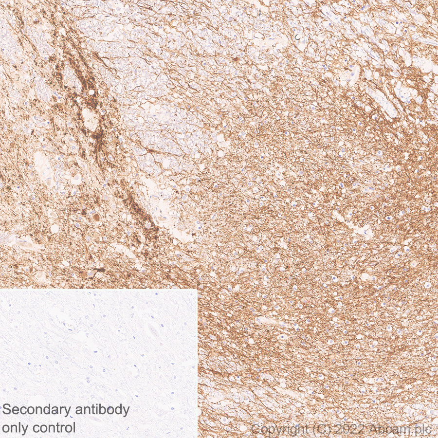 Immunohistochemistry - Anti-TAC1 antibody [EPR26567-18-1-3] - BSA and Azide free (AB307139), expandable thumbnail