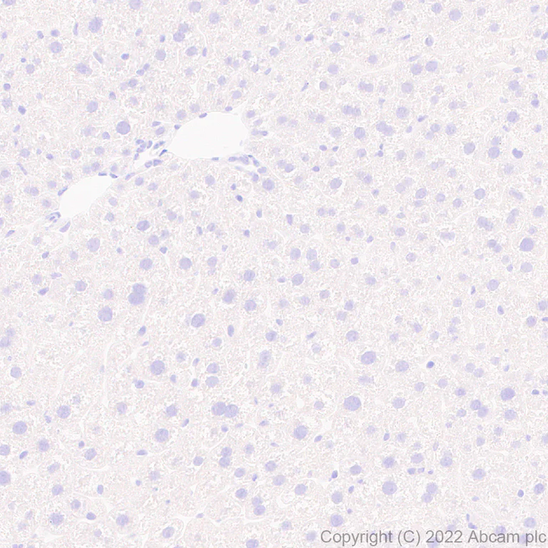 Immunohistochemistry - Anti-TAC1 antibody [EPR26567-18-1-3] - BSA and Azide free (AB307139)