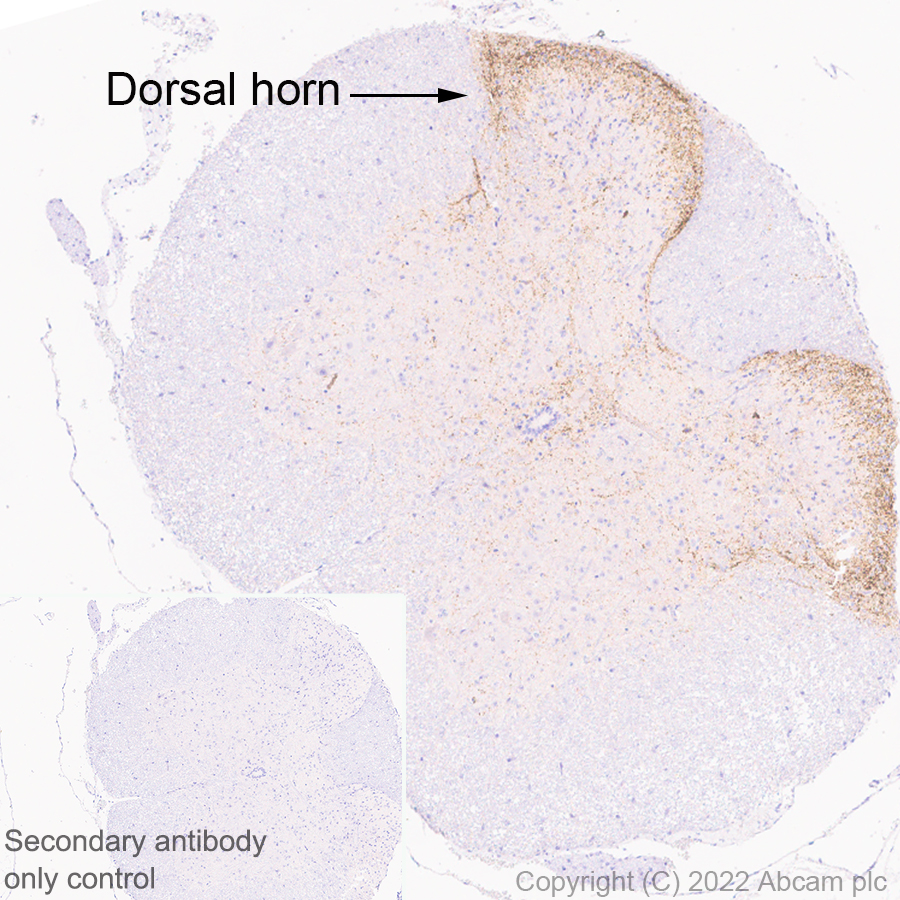 Immunohistochemistry - Anti-TAC1 antibody [EPR26567-18-1-3] - BSA and Azide free (AB307139), expandable thumbnail