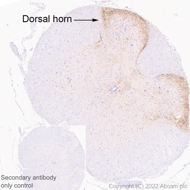 Immunohistochemistry - Anti-TAC1 antibody [EPR26567-18-1-3] - BSA and Azide free (AB307139)