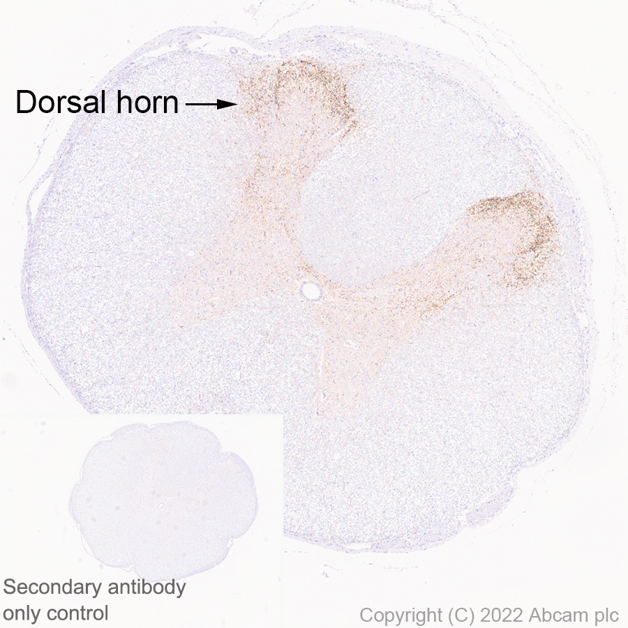 Immunohistochemistry - Anti-TAC1 antibody [EPR26567-18-1-3] - BSA and Azide free (AB307139), expandable thumbnail