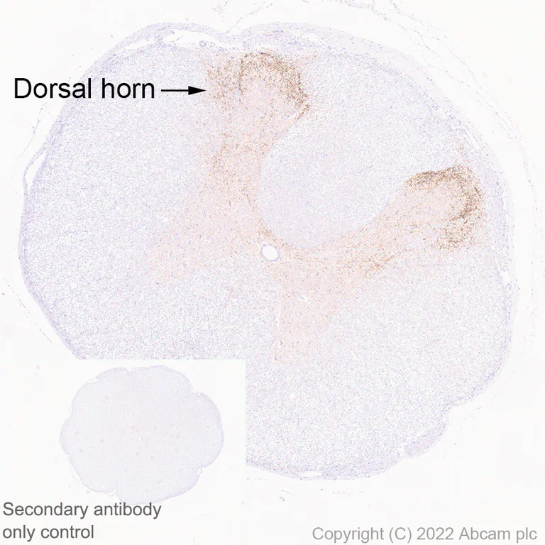 Immunohistochemistry - Anti-TAC1 antibody [EPR26567-18-1-3] - BSA and Azide free (AB307139)