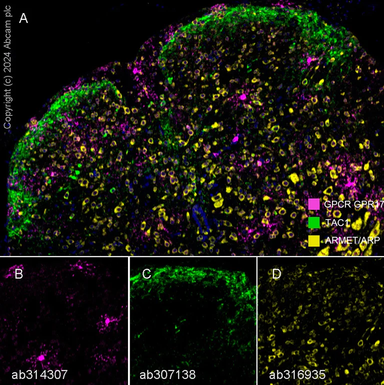 Multiplex immunohistochemistry - Anti-TAC1 antibody [EPR26567-18-1-3] - BSA and Azide free (AB307139)