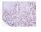 Immunohistochemistry (Formalin/PFA-fixed paraffin-embedded sections) - Anti-TACC2 antibody (AB96760), expandable thumbnail