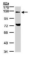 Western blot - Anti-TACC2 antibody (AB96760), expandable thumbnail