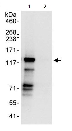 Immunoprecipitation - Anti-TACC3 antibody (AB245455)