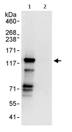 Immunoprecipitation - Anti-TACC3 antibody (AB245455)