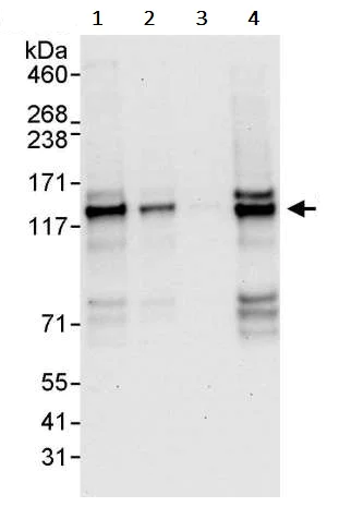 Western blot - Anti-TACC3 antibody (AB245455)