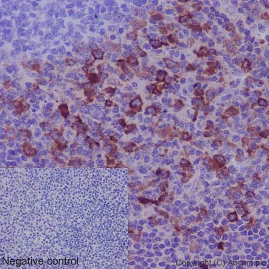 Immunohistochemistry (Formalin/PFA-fixed paraffin-embedded sections) - Anti-TACC3 antibody [EPR7756] (AB134154)