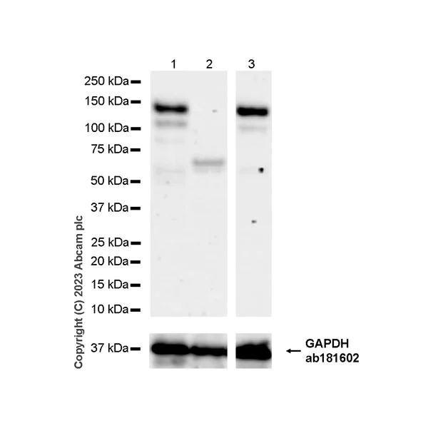 Western blot - Anti-TACC3 antibody [EPR7756] (AB134154)