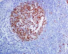 Immunohistochemistry (Formalin/PFA-fixed paraffin-embedded sections) - Anti-TACC3 antibody [EPR7756] - BSA and Azide free (AB224525)