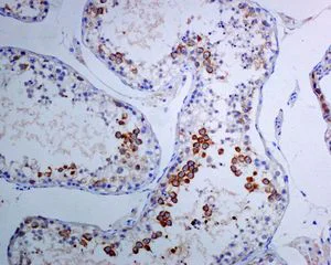 Immunohistochemistry (Formalin/PFA-fixed paraffin-embedded sections) - Anti-TACC3 antibody [EPR7756] - BSA and Azide free (AB224525)