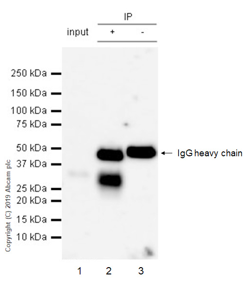 Immunoprecipitation - Anti-TACI antibody [EPR23045-153] (AB239370), expandable thumbnail