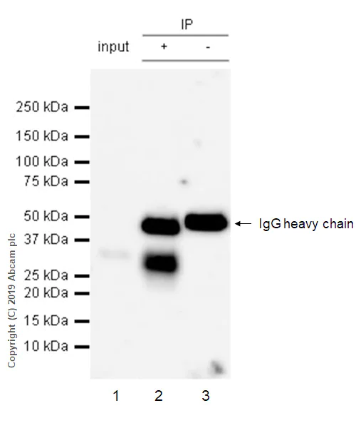 Immunoprecipitation - Anti-TACI antibody [EPR23045-153] - BSA and Azide free (AB269588)