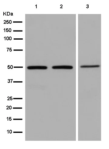 Western blot - Anti-TADA3L antibody [EPR13864] (AB181984)