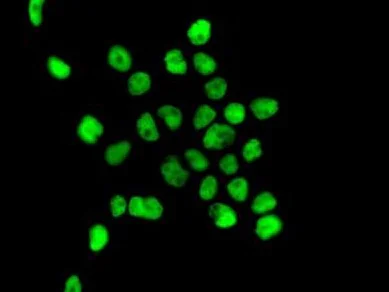 Immunocytochemistry/ Immunofluorescence - Anti-TAF15 antibody [EPR9196(B)] (AB133760)