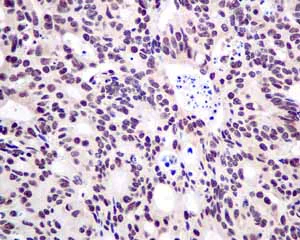 Immunohistochemistry (Formalin/PFA-fixed paraffin-embedded sections) - Anti-TAF15 antibody [EPR9196(B)] (AB133760)