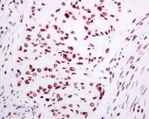 Immunohistochemistry (Formalin/PFA-fixed paraffin-embedded sections) - Anti-TAF15 antibody [EPR9196(B)] (AB133760)