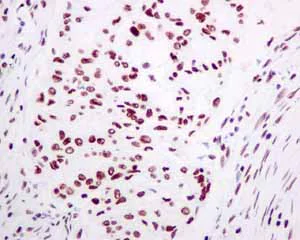Immunohistochemistry (Formalin/PFA-fixed paraffin-embedded sections) - Anti-TAF15 antibody [EPR9196(B)] (AB133760)