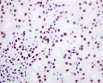 Immunohistochemistry (Formalin/PFA-fixed paraffin-embedded sections) - Anti-TAF15 antibody [EPR9196(B)] (AB133760)